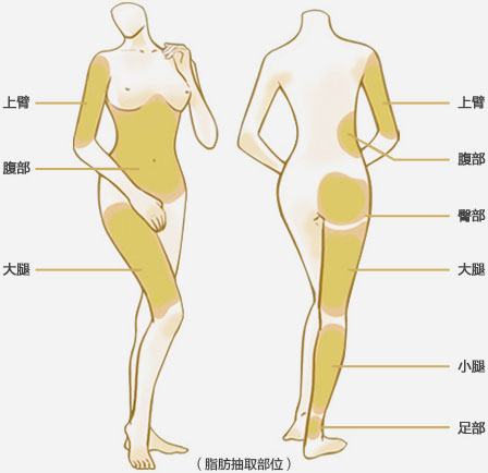 脂肪抽取部位